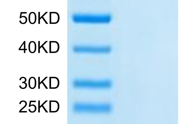 20220801141917 600x400 - Cynomolgus DDT Protein, Accession: XP_005595435