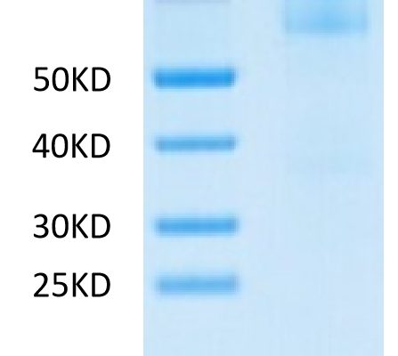20230403161006 447x400 - Mouse FAP Protein, Accession: P97321