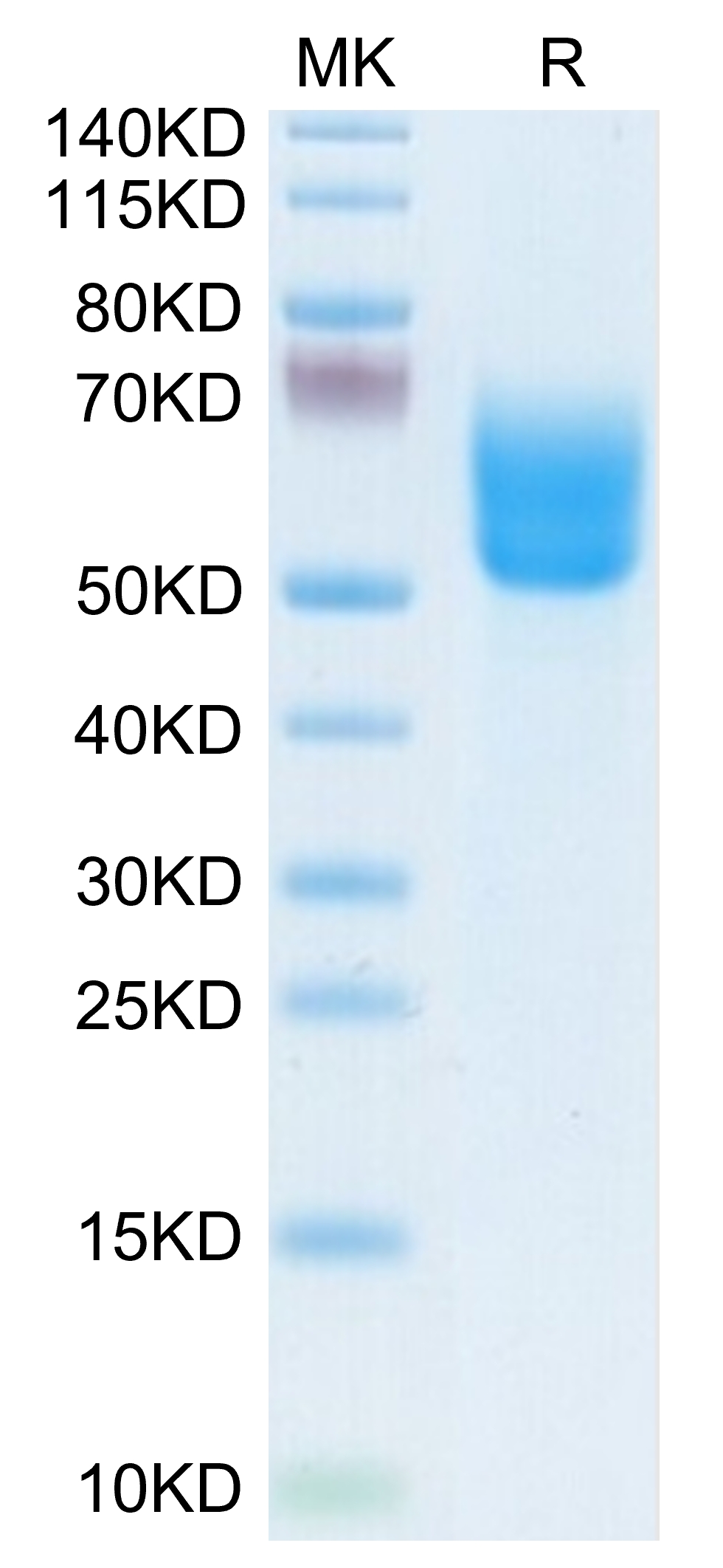 1596783421812368 - Biotinylated Human DKK3 Protein, Accession: Q9UBP4