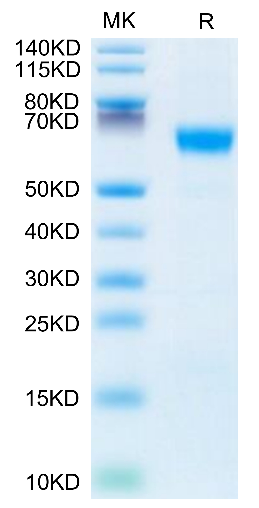 Mouse MFGE-8 Protein, Accession: P21956 20210625123055 - Mouse MFGE-8 Protein, Accession: P21956