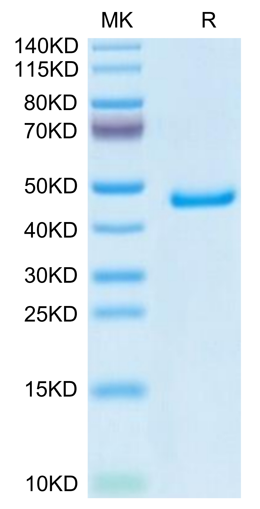 Mouse GP1BB Protein, Accession: P56400 Watson International Limited