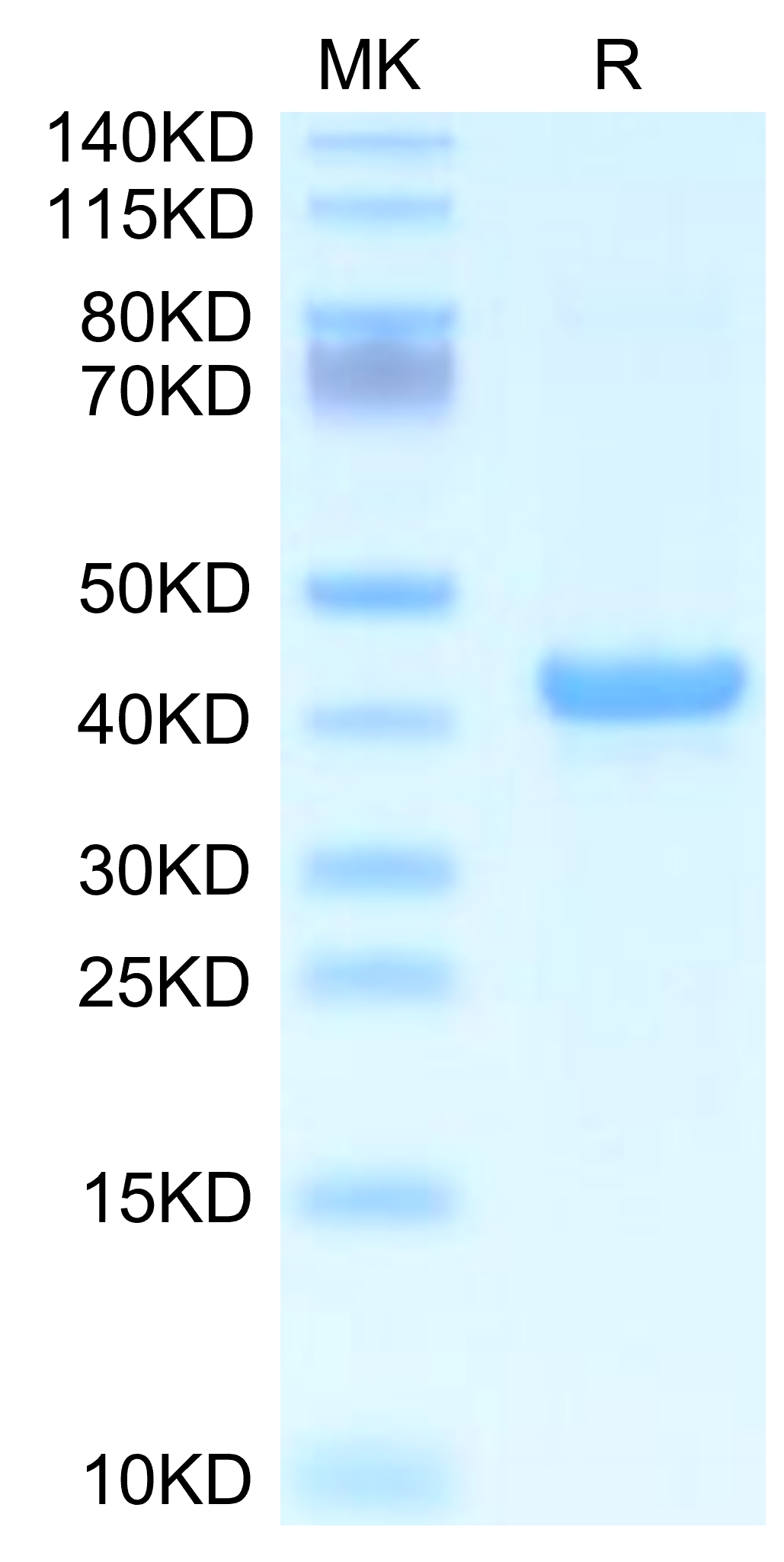20210903110419 - Mouse APOA5 Protein, Accession: Q8C7G5