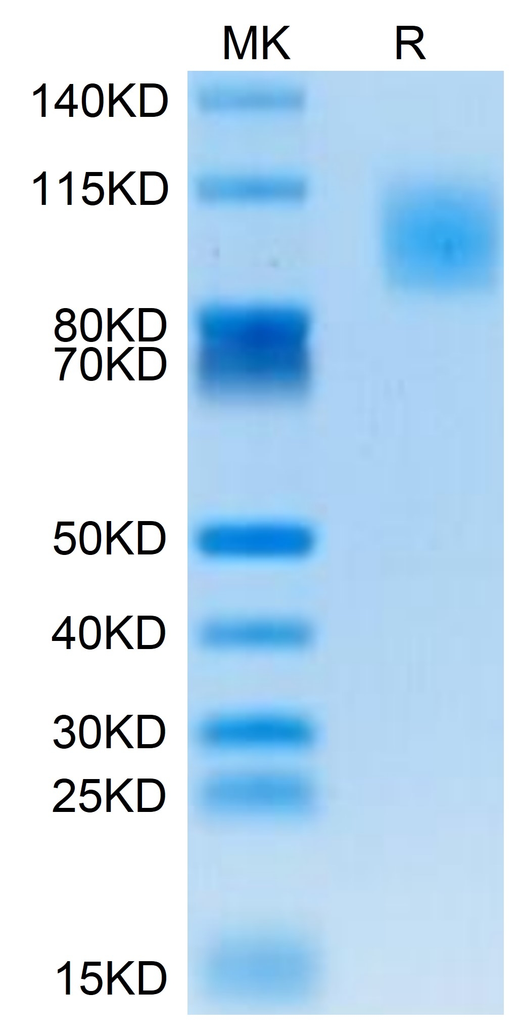 20211019150150 - Human PODXL2 Protein, Accession: Q9NZ53
