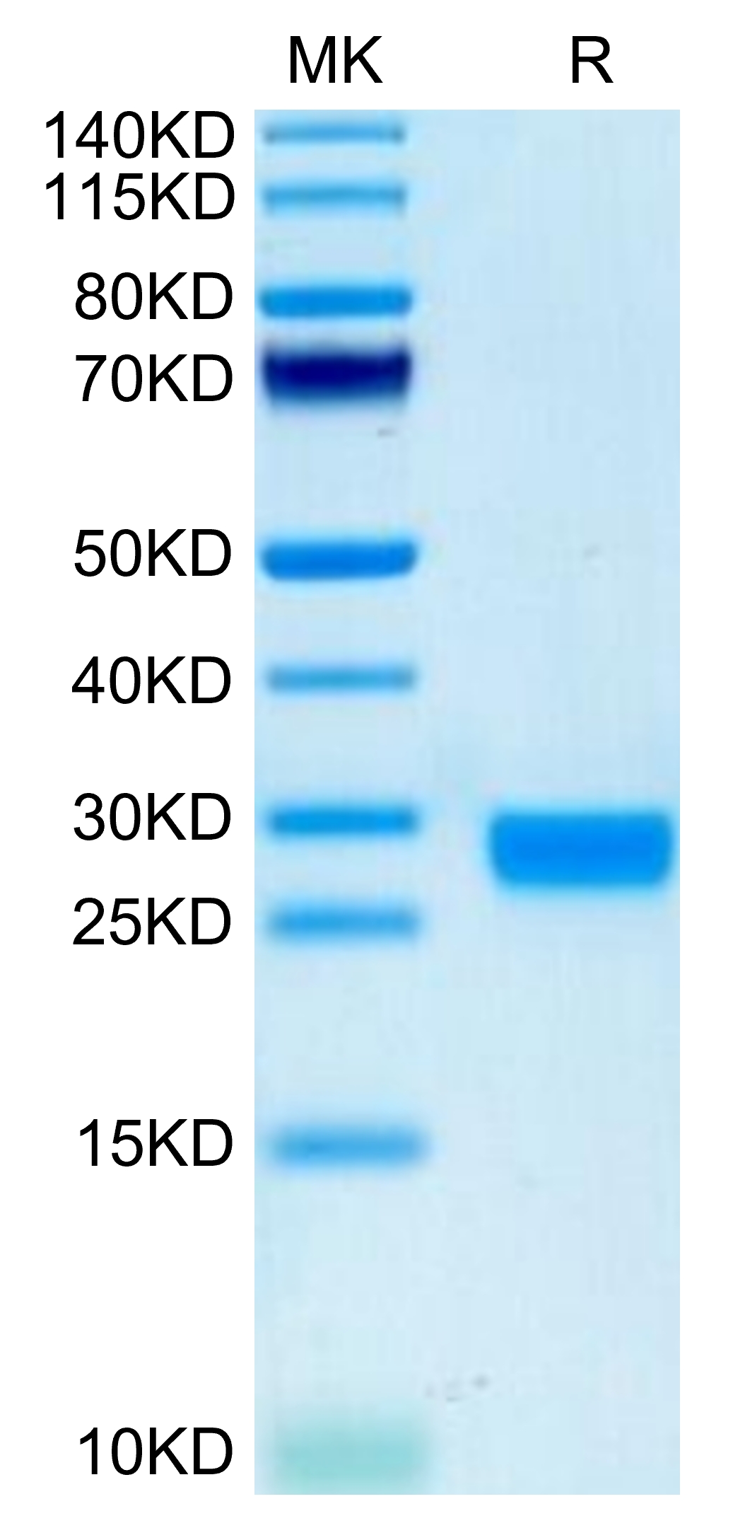 20211029102033 - Biotinylated Mouse IL-2 Protein, Accession: P04351