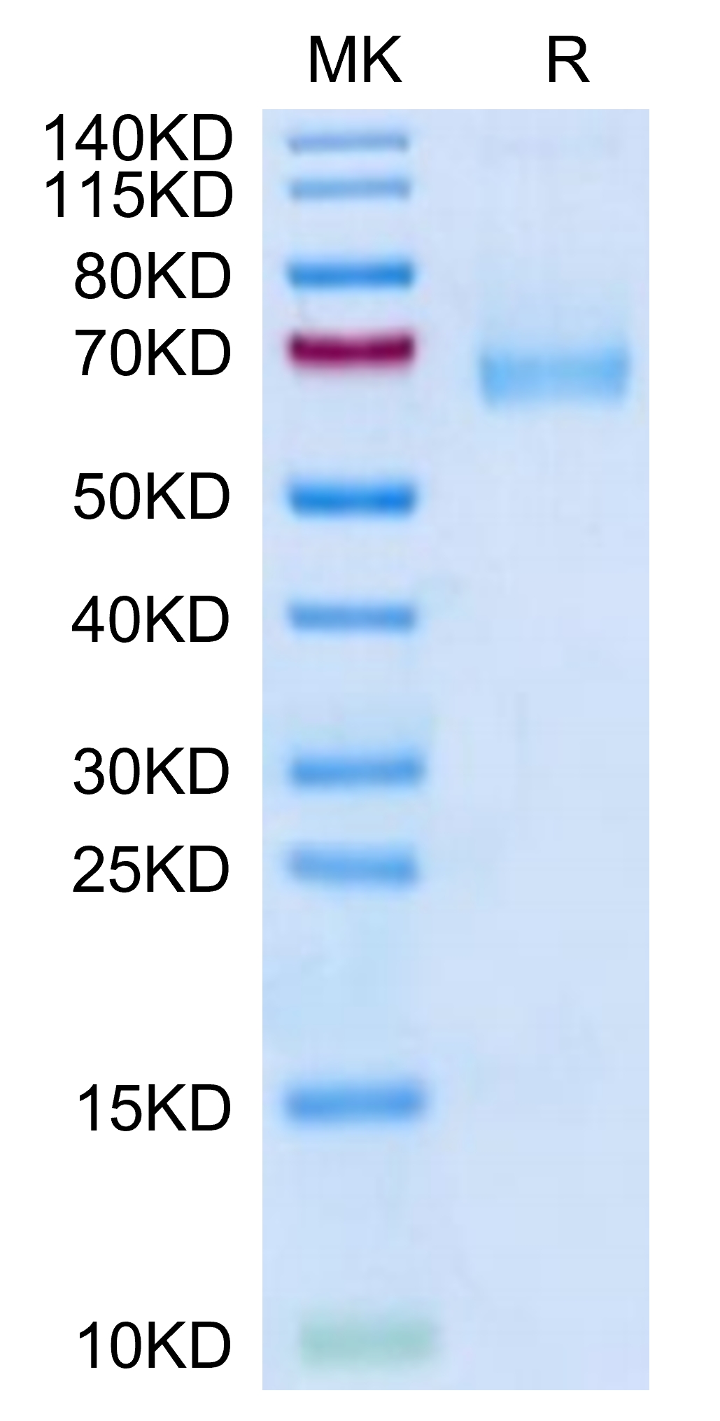 Mouse IL-7R alpha/CD127 Protein, Accession: NP_032398 Watson ...