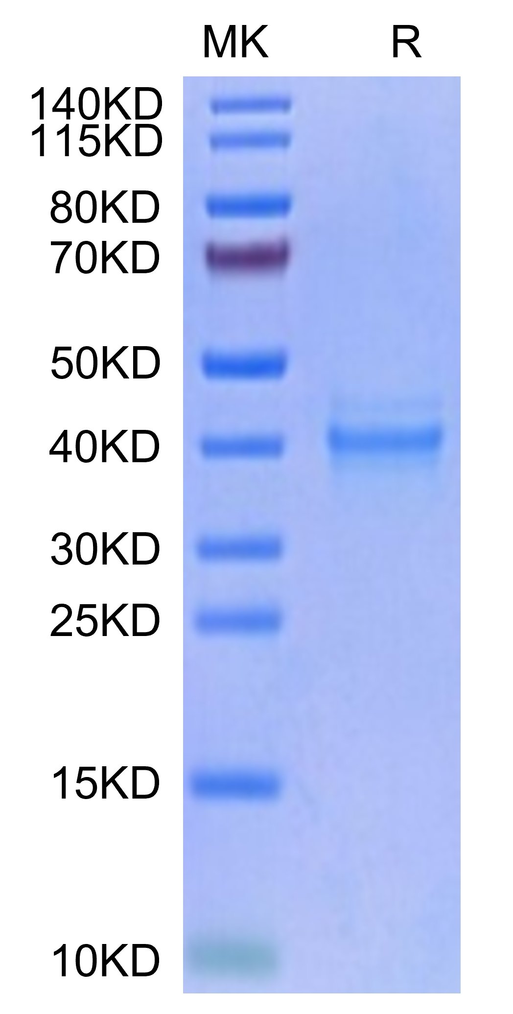 20220121094827 - Human IL-12 Protein, Accession: P29460