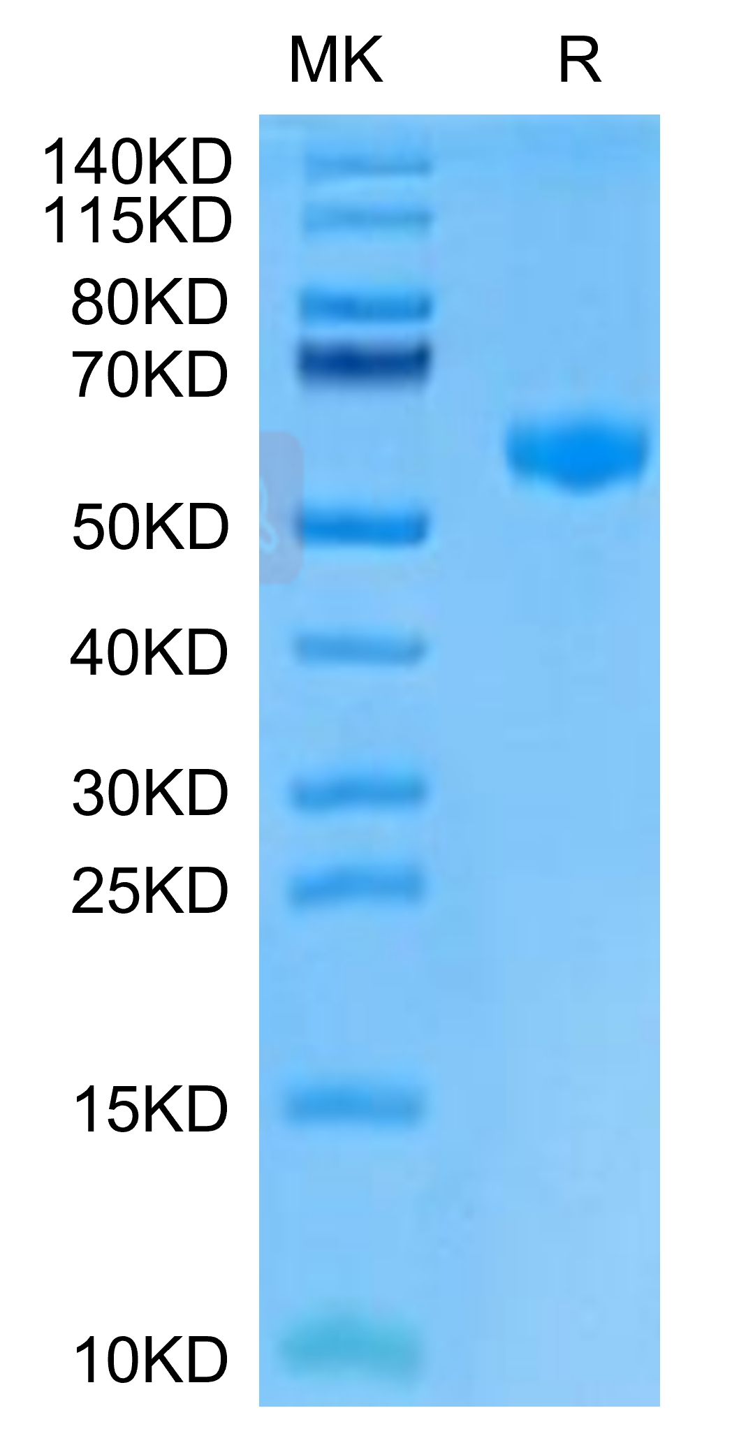Mouse Pvg Mouse PVRIG Protein, Accession: A0A1B0GS01 Watson International Limited