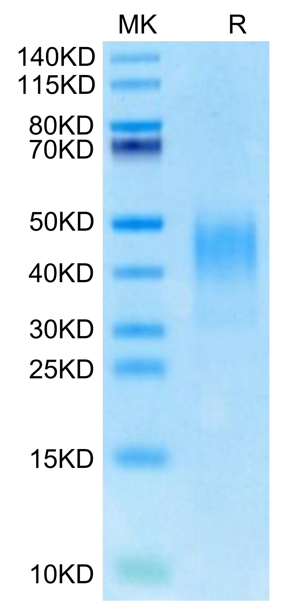 20220420153950 - Cynomolgus PD-L2/B7-DC Protein, Accession: XP_005581839