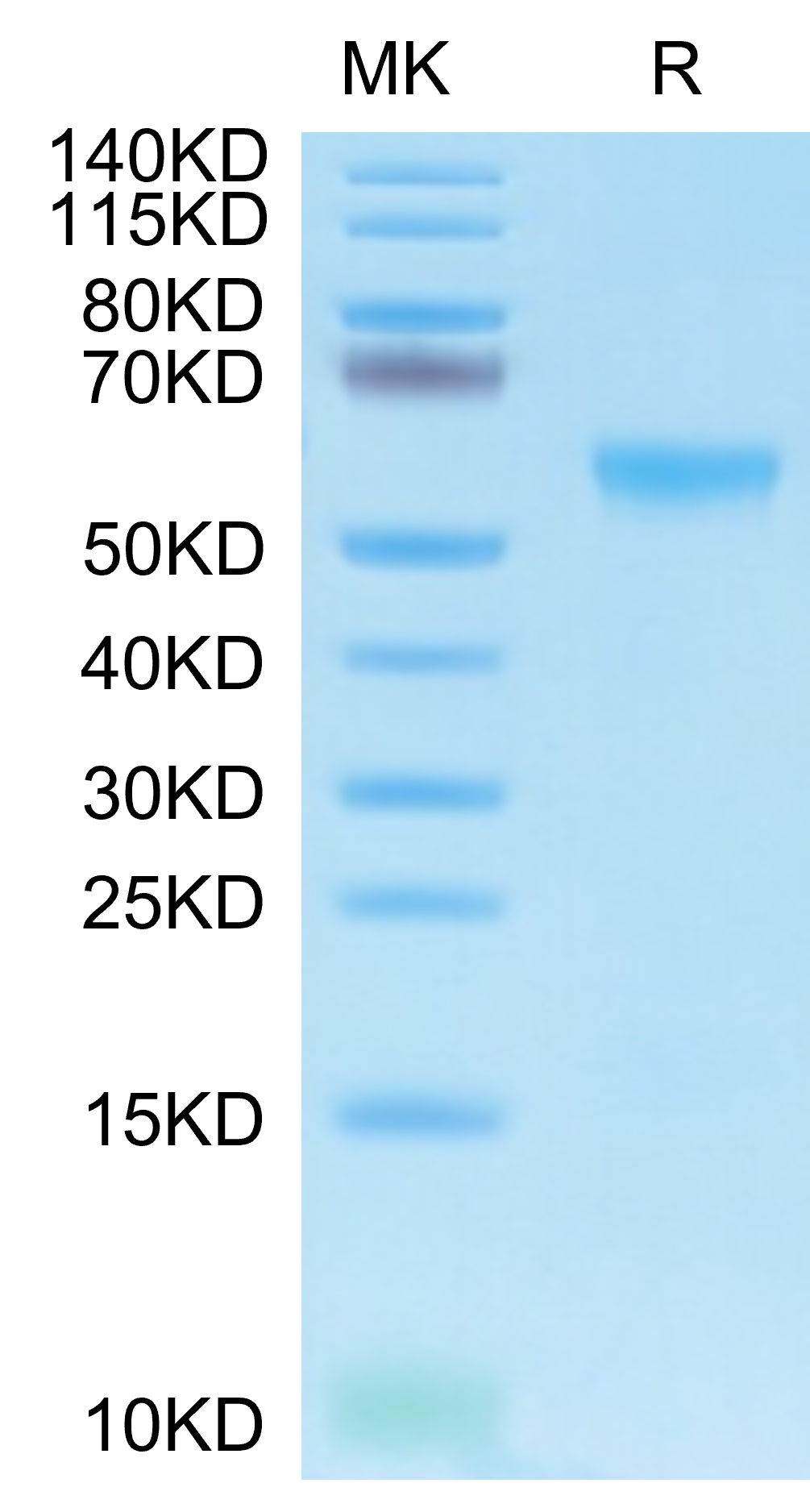 Biotinylated Human APRIL/TNFSF13 Trimer Protein, Accession: O75888 ...