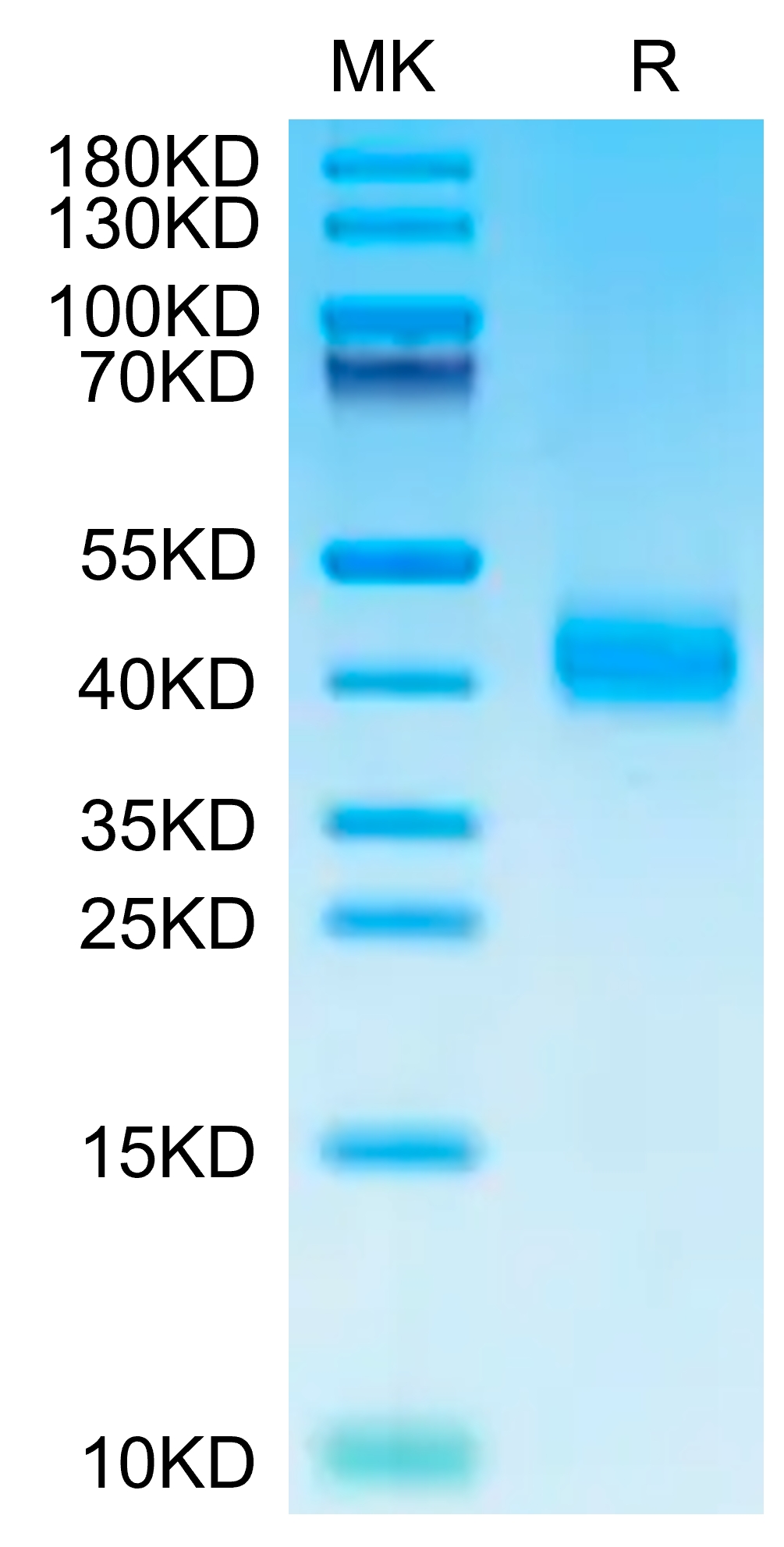 20221104141415 - Human ASGR1 Protein, Accession: P07306