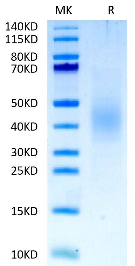 20230330112803 - Biotinylated Human FGFR2 beta (IIIb) Domain Protein, Accession: P21802